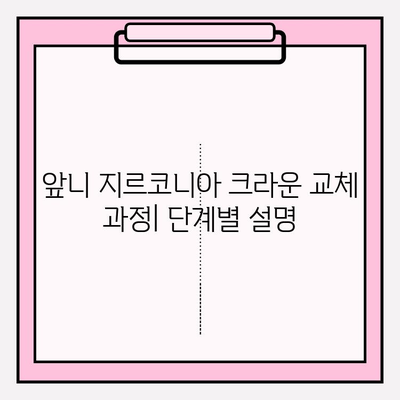 앞니 재신경 치료 후 PFM 크라운을 지르코니아 크라운으로 변경하는 과정 | 앞니, 뿌리염증, 치료, 크라운, 교체