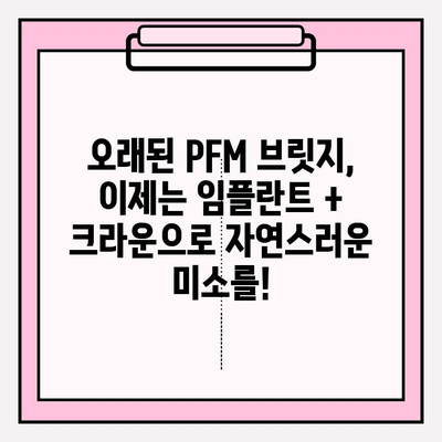 오래된 PFM 브릿지 교체, 충남 금산치과의 임플란트 + 크라운 치료법| 자연스러운 미소를 되찾는 최적의 선택 | 임플란트, 크라운, 치아교체, 금산치과, PFM 브릿지