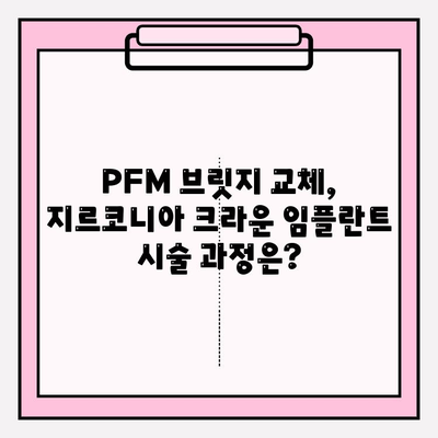 오래된 PFM 브릿지, 지르코니아 크라운 임플란트로 새롭게! | PFM 브릿지 교체, 지르코니아 크라운 임플란트 장점, 시술 과정