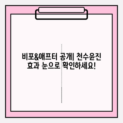 고급스러운 피부 관리, 천수윤진이 정말 효과적일까? 솔직 후기 & 비포애프터 공개 | 천수윤진, 피부 고민, 솔직 후기, 비포애프터, 효과, 가격