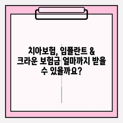 임플란트 & 크라운 보험금, 내 치아보험으로 얼마나 받을 수 있을까요? | 치아보험, 보상, 약관 분석, 임플란트 보험금