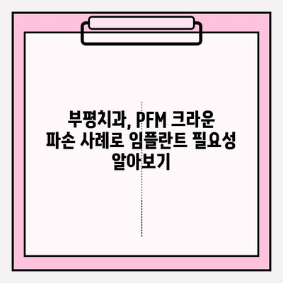 PFM 크라운 파손, 임플란트가 답일까요? 부평치과 사례를 통해 알아보세요 | PFM 크라운, 임플란트, 치과, 부평