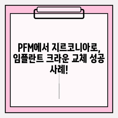 PFM 임플란트 크라운 파손, 지르코니아 교체로 새롭게! | 임플란트 크라운, 지르코니아, 파손, 교체, 사례