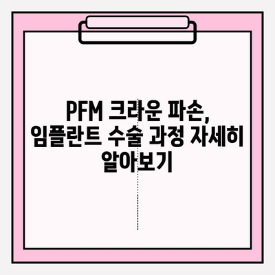 PFM 크라운 파손, 임플란트가 답일까요? 부평 치과 추천 & 수술 가이드 | 임플란트, PFM 크라운, 부평 치과, 치과 추천, 치과 상담