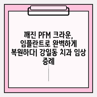 PFM 크라운 파절 후 강일동 치과 임플란트 재세팅 임상 증례| 성공적인 치료 과정과 결과 | 임플란트, 치과, 강일동, PFM 크라운, 파절, 재세팅