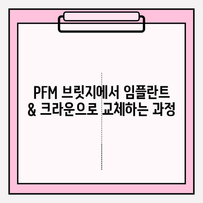 PFM 브릿지, 임플란트 & 크라운으로 교체| 장점과 과정, 비용까지 | 치과, 임플란트, 브릿지, 크라운, 치료