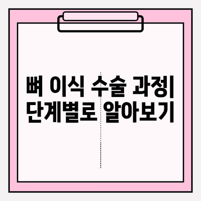 임플란트 뼈 이식| 고정을 위한 단계별 가이드 | 임플란트, 뼈 이식, 치과 수술, 치아 건강