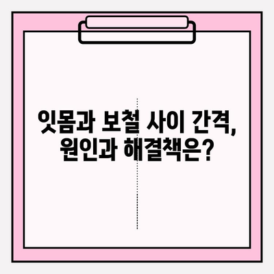 PFM 임플란트 교체| 잇몸과 보철 사이 간격 해소하는 방법 | 임플란트, 보철, 잇몸, 치과