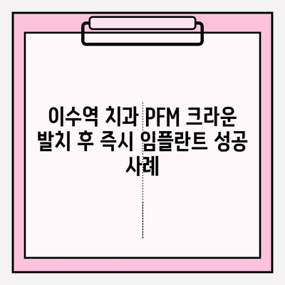 이수역 치과 PFM 크라운 발치 후 즉시 임플란트 성공 사례| 환자 만족도 높은 치료 후기 | 임플란트, 치과, 이수역