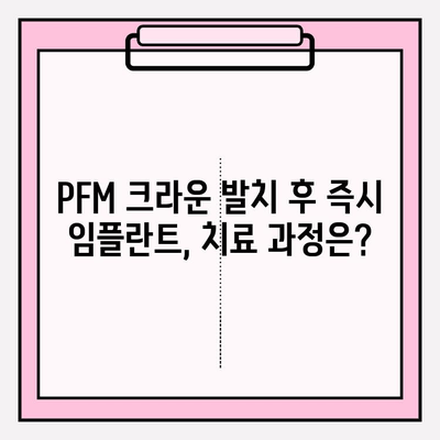 PFM 크라운 발치 후 즉시 임플란트, 성공적인 사례와 주의사항 | 임플란트, 치과, PFM 크라운, 발치, 즉시 임플란트