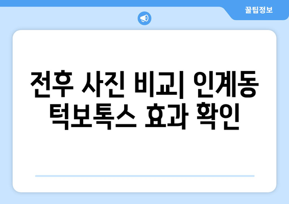 인계동 턱보톡스 성공 사례| 전후 사진 비교 & 후기 | 턱선, V라인, 얼굴 윤곽, 보톡스 후기